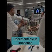 Robotic Hip Replacement On Bone Model Hipreplacementsurgery Robotics