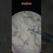 Spot Strange Organisms When Viewed Out Of Date Pate Under A Microscope Shorts Microscope