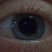 Pupil Dilation And Contraction