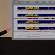 Introduction To QEEG