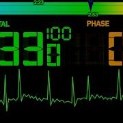 BCG 4 Minutes 33 Seconds Countdown 3 Phase Heart Rate Progress Bar Remix Game Of Life 2000 Theme