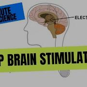 2 Minute Neuroscience Deep Brain Stimulation