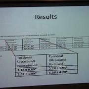 Radiused Phacoemulsification Tip Efficiency And Chatter ARCHIVE