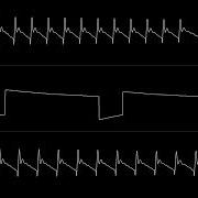 Tim Follin Bionic Commando C64 Full Soundtrack Oscilloscope View