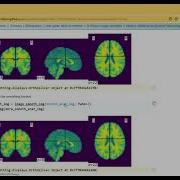 Nilearn Package Of Python Simple Example