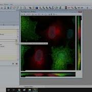Autoquant Deconvolution Tutorial