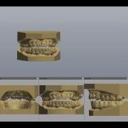 3Shape TRIOS Ortho Study Model For Retainer Model Set