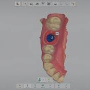 3Shape TRIOS Implant Restoration Workflow IT