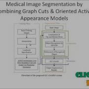 Final Year Projects Medical Image Segmentation By Combining Graph Cuts And Oriented Active