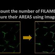 How To Count The Number Of FILAMENTS And Measure Their AREAS Using ImageJ Fiji