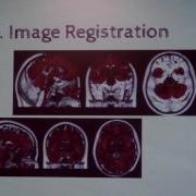 Data Analysis In MRI And PET MRI Neuroimaging Davide Poggiali