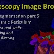 MIB Image Segmentation Tutorial 5 Thresholding With Statistical Filtering