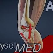 What Role Does The ACL Play In Sports ACL Series