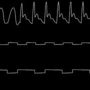 C64 Georg Feil S Synth Sample Oscilloscope View