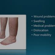 Complications After Hip Surgery