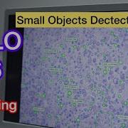 YOLOv26 For Small Object Detection Segmentation In Custom Dataset With YOLO26 SAHI Yolov26