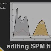 Statistical Parametric Mapping SPM Edit Figures