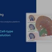 BioTuring Lens Spatial Deconvolution On Visium Data