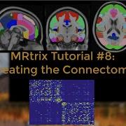 MRtrix Tutorial 8 Creating The Connectome