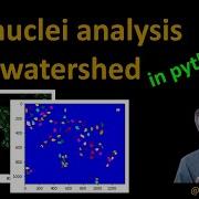 35 Cell Nuclei Analysis In Python Using Watershed Segmentation