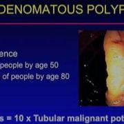 UCSF Radiology Using Diagnostic Imaging To Find Polyps