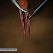 Basic Skills 2018 Fine Dissection