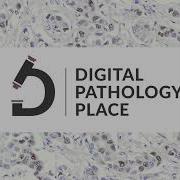 70 Digital Pathology 101 Chapter 1 Part 1 Digital Pathology Milestones And Basic Digitalizat