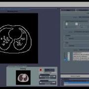 Edge Maximization Technique Image Segmentation Matlab Projects