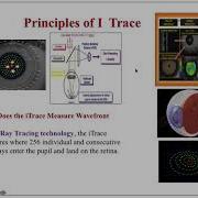 Lecture Wavefront Aberrometry And ITrace Screening And Planning Surgeries