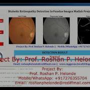 Diabetic Retinopathy Detection Using Image Processing Matlab Final Year IEEE Project Code
