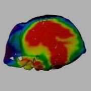 Maximum Intensity Projection Raycasted Onto CT In The Monkey Dataset
