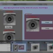 Final Year Projects Iris Recognition Using Possibilistic Fuzzy Matching On Local Features