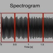 Spectrogram