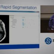 Rapid Accurate And Simple Segmentation Of OBjects In Medical Images SciPy 2015 Ross Mitchell
