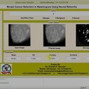 Matlab Code For Breast Cancer Detection And Classification In Mammogram Using Neural Network