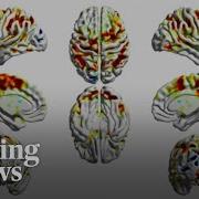 How Smartphone Addiction May Be Hurting Our Brains