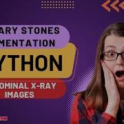 Python Image Processing Project Urinary Stones Segmentation In X Ray Image ClickMyProject