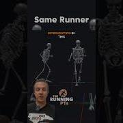 3D Gait Analysis Better Performance