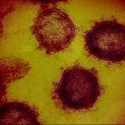 New Study Shows COVID 19 Can Be Spread By Just Speaking Or Breathing