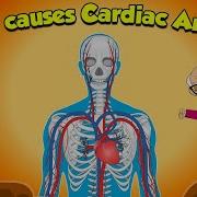 Heart S Electrical System Failure What Causes Cardiac Arrest Heart Conditions Dr Binocs