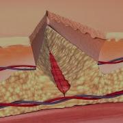 How Your Body Heals Cuts Scrapes And Puncture Wounds To The Skin