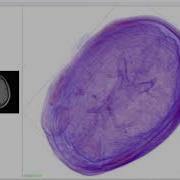 NMRI 3D View