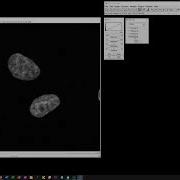 Basic Adjustments Of Fluorescent Images With FIJI