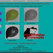 Walnut Disease Detection Using CNN Convolutional Neural Network Python Project With Source Code