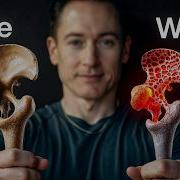 How Weak Are Your Bones Test Fix