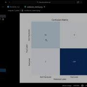 Facture Vision AI Bone Fracture Classification Deep Learning Project