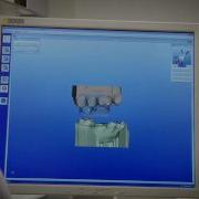CEREC Biogeneric Workflow