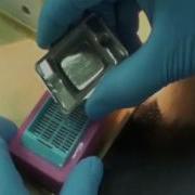 Preparation Of Paraffin Recipient Blocks By Mold Kit