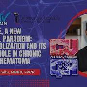 MMA Embolization And Its Evolving Role In Chronic Subdural Hematoma Dheeraj Gandhi MBBS FACR