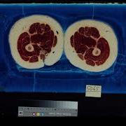 Visual Human Project Female Cadaver 4k60FPS